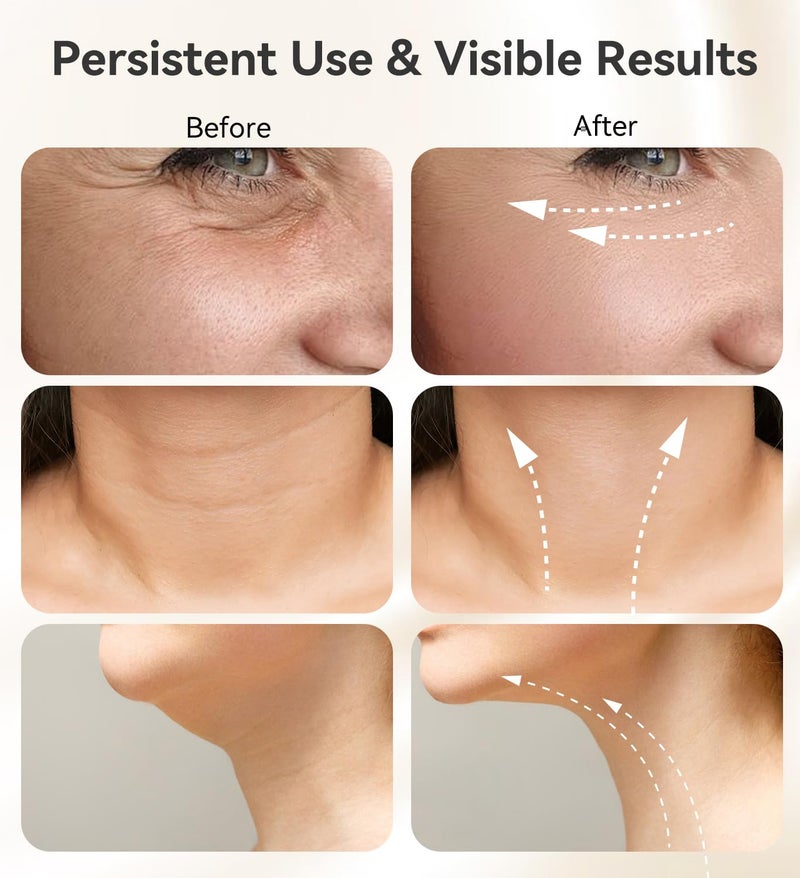 مدلك للوجه، 3 ألوان علاج بالضوء الأحمر للوجه والرقبة للتجاعيد والذقن المزدوجة، مدلك للوجه بالاهتزاز مع حراري أبيض - Image 5